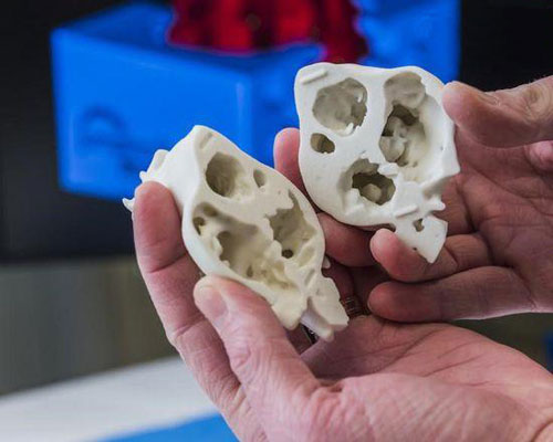 3D打印造福医疗行业