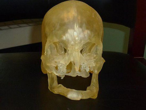 这是一个计划用于面部移植的3D打印模型。
